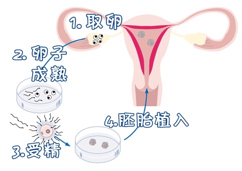 专家